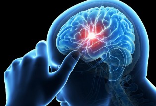 مهم‌ترین نشانه‌های سکته مغزی/ اختلال ناگهانی در تکلم را جدی بگیرید